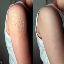 Load image into Gallery viewer, Preventology - Colloidal Silver First Aid Gel